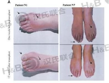 1574318400885676.jpg 2.jpg