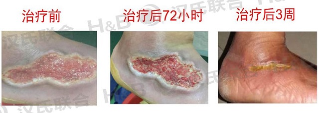 1574318427982123.jpg 3.jpg