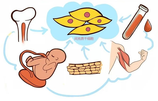 间充质干细胞存储 存干细胞就选汉氏联合