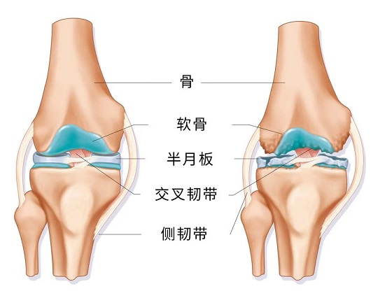 干细胞存储的作用 干细胞治疗骨质疏松