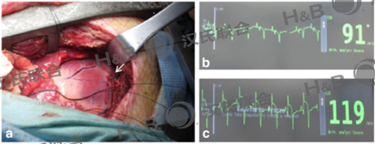 1606207604629675.png 3.png