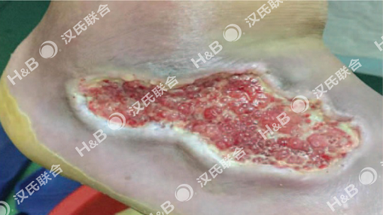 1606443758715796.png 6.png