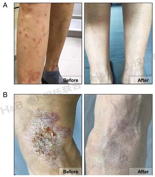 干细胞有什么用 干细胞有什么用