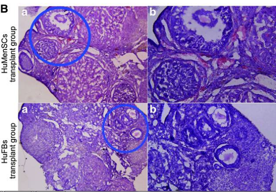 新手父母要不要给孩子存胎盘干细胞 干细胞可以治疗那些疾病