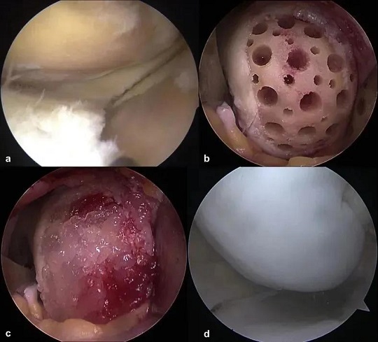 汉氏联合干细胞治疗亚健康
