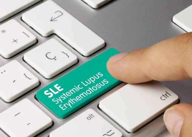 干细胞治疗红斑狼疮