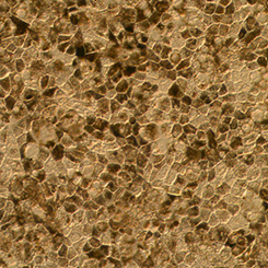 美干细胞公司治疗失明症通过临床测试