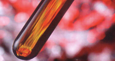 造血干细胞可改善1型糖尿病小鼠病情