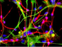 干细胞注射可防治脑中风后认知障碍