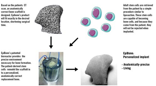 干细胞培养,活骨再生