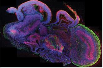 类器官的横切面展示大脑的不同区域