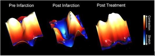 心脏再同步的生物治疗措施