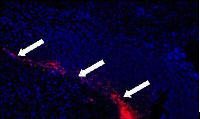 自动导航的间充质干细胞