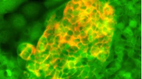 前肠干细胞（绿色）分化成表达胰岛素的胰腺细胞