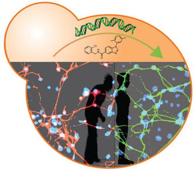 帕金森氏症治疗新发现