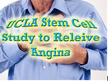 干细胞治疗改善心绞痛