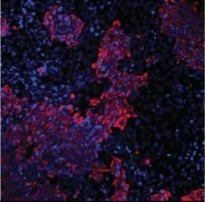 干细胞研究揭示糖尿病β细胞衰竭机制