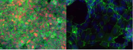 干细胞如何维持“干性”