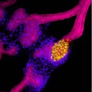 人类干细胞培育的肾原基，黄色区域干细胞从集合管系分化为肾祖细胞