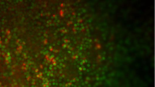 科学家将人胚胎干细胞转化为功能性肺上皮细胞(绿色)