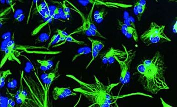 班加罗尔干细胞储存意识位居榜首