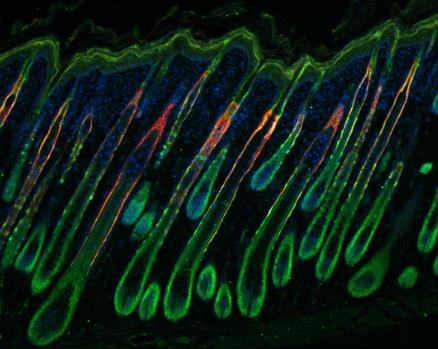 研究发现干细胞处于休眠状态时可抑制癌症