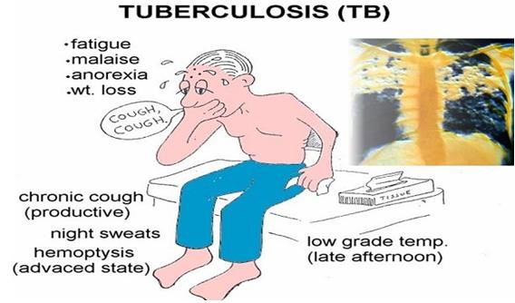 干细胞战胜耐药结核病