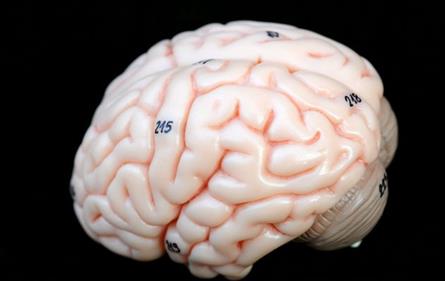 干细胞用于脑瘫儿